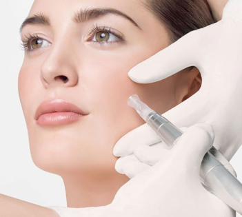 Microneedling